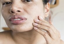 Decoded: Why your face feels ‘tight’ after being washed