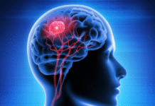 Scientists Identify Key Enzyme That Could Halt Aggressive Brain Cancer