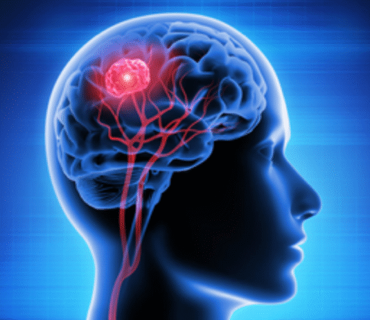 Scientists Identify Key Enzyme That Could Halt Aggressive Brain Cancer