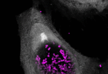 Researchers Discover Molecule That Can Kill Chlamydia Without Harming Healthy Bacteria
