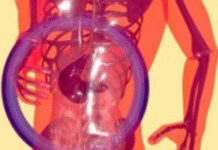 Fatty Liver During Pregnancy May Raise Risk of Preterm Birth, Study Finds