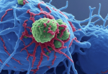 Twin studies report global rise in gastrointestinal cancers among middle-aged adults