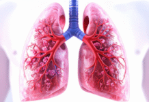 Higher dose of rifampicin safe and may improve long-term outcomes in lung TB: ICMR study