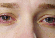 Study: One Hour of Social Media Reels on Smartphones Can Trigger Eye Fatigue