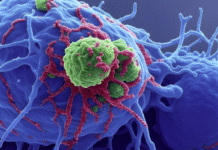 Study Identifies New Genomic Risk Factors for Uterine Cancer