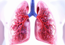 Experimental Antibody Drug Shows Early Success Against Aggressive Lung Cancer