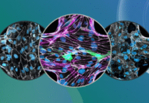 Study Reveals How Malaria Parasite Breaks Down Brain’s Protective Barrier