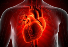 Study Finds Cardiovascular Diseases Caused One in Three Deaths Globally in 2023