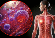 High-Fat Keto Diet May Increase Risk of Aggressive Breast Cancer, Study Warns