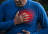 Stem Cell Therapy Shows Promise in Preventing Heart Failure After Heart Attack
