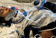 US: Indian girl in coma after crash; community mobilizes to help