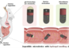 IIT Delhi and AIIMS Develop Swallowable Device to Sample Bacteria From the Small Intestine