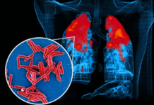 IIT Bombay Study Reveals How TB Bacteria Reinforce Their Outer Coating to Survive Antibiotics