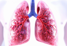 New Blood Test Shows Promise for Real-Time Detection and Monitoring of Lung Cancer