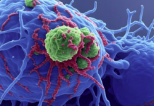 Hyaluronic Acid Gel Shows Promise in Improving Radiation Treatment for Gynecological Cancers, Study Finds