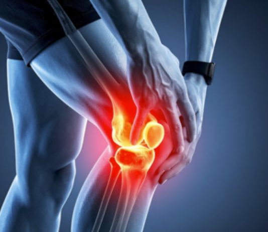 Winter, Pollution, Lifestyle Changes Driving Rise in Autoimmune Diseases Among Women, Expert Says