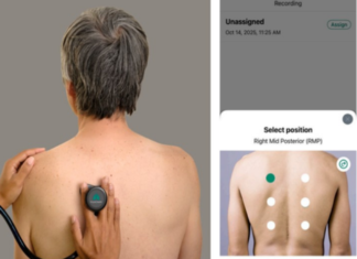 AI-Enabled Digital Stethoscopes Could Help Close Tuberculosis Screening Gaps, Study Finds